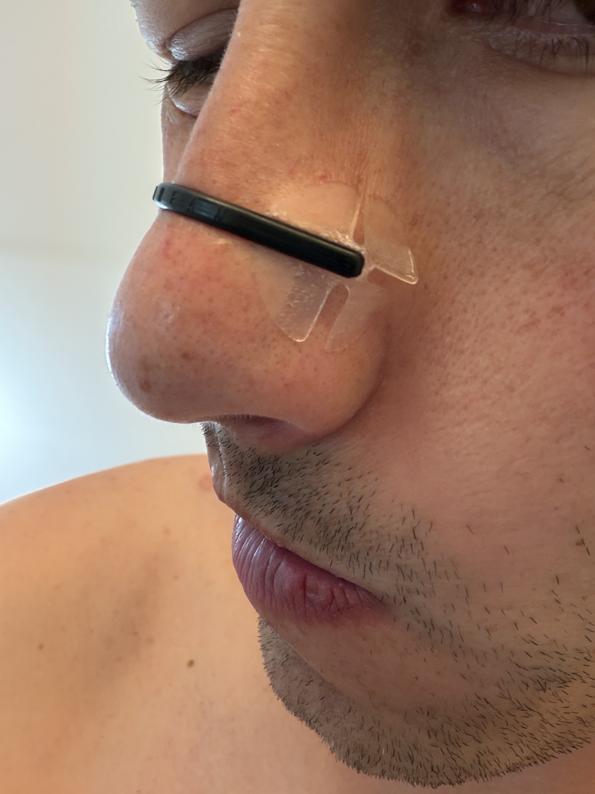 Dream Recovery Second Wind worn, side profile showing the rigid bar and adhesive pad